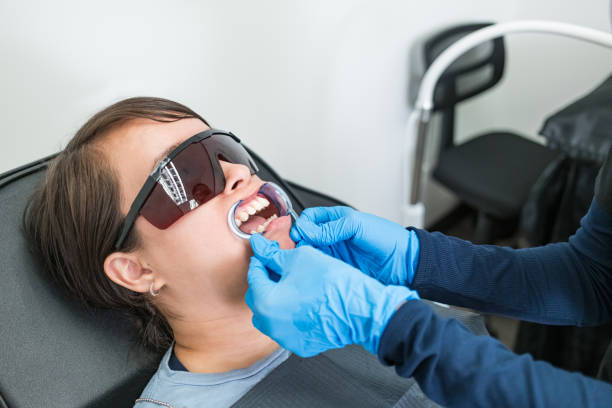 Best Emergency Wisdom Tooth Extraction in Beach Park, IL