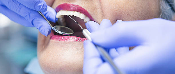 Best Emergency Treatment for Oral Infections in Beach Park, IL